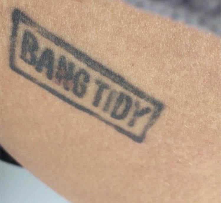 Tattoo Removal Archives | Skin MD Laser & Cosmetic Group